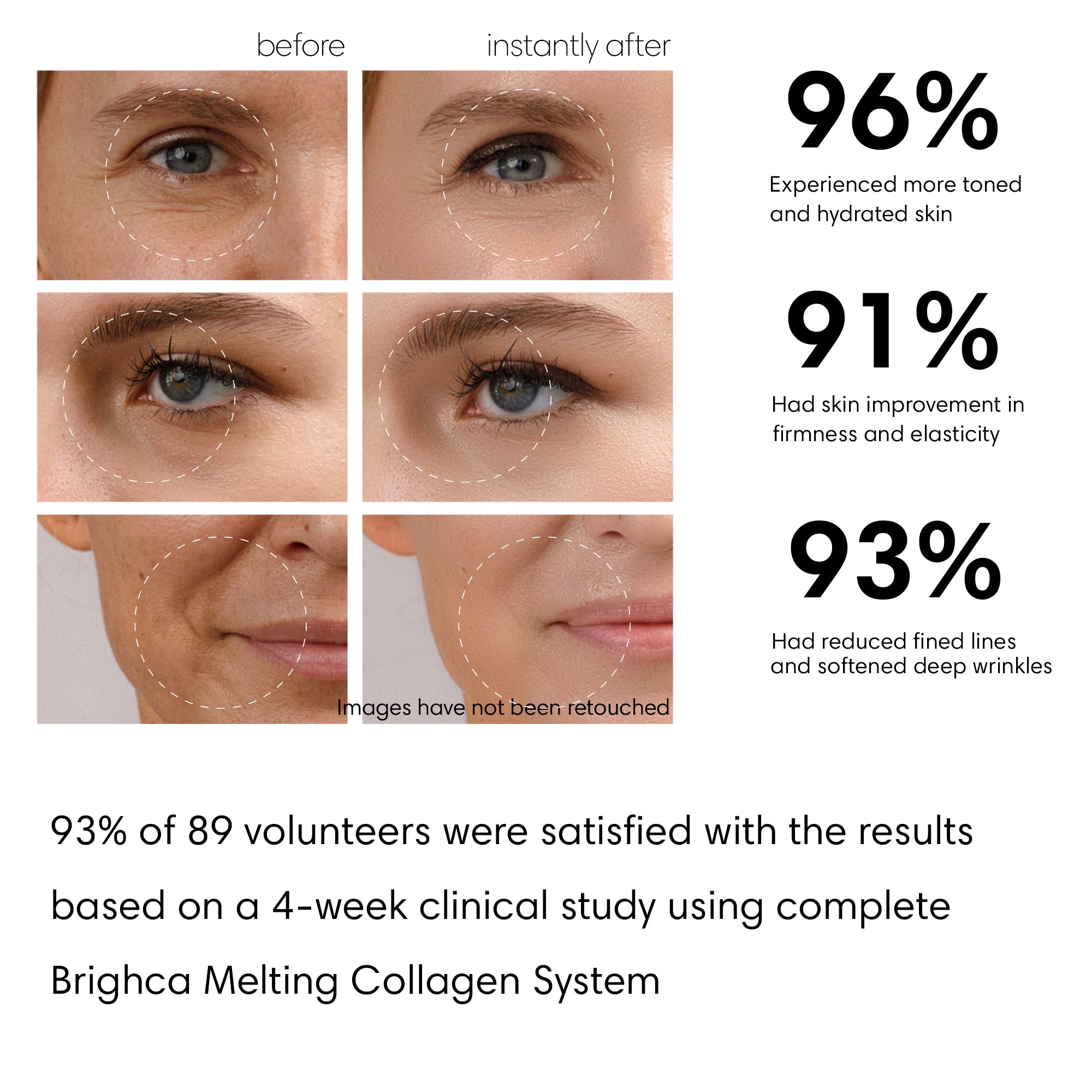 Melting Nanofiber Collagen Film Face Treatment Brighca for anti-aging, lifting, firming, hydrating result